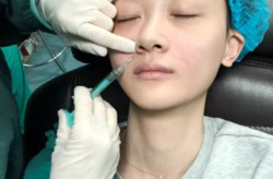被吃瓜的医美网红,揭秘网红背后的医美真相